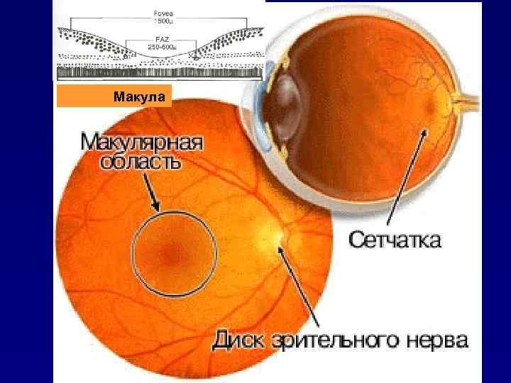 Макула 