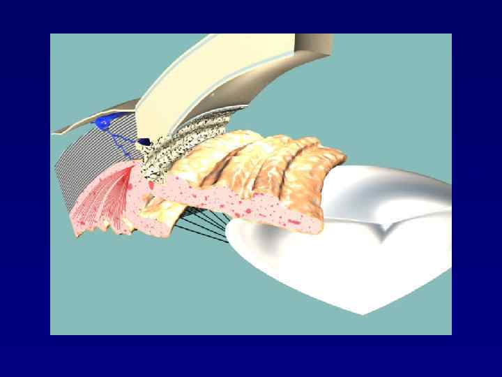 Радужка Дилятатор 