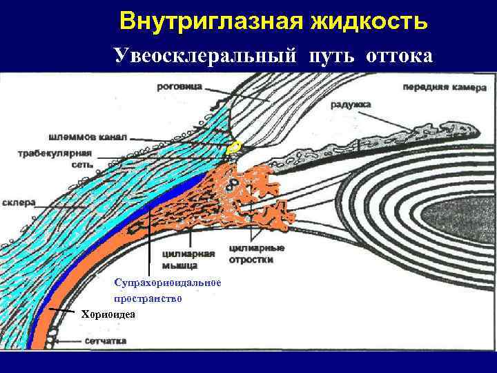 Внутриглазная жидкость Увеосклеральный путь оттока Радужка Супрахориоидальное пространство Супрахориоидальное Хориоидеа пространство Дилятатор 