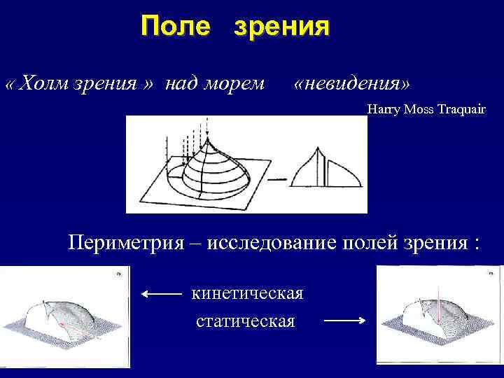 Поле зрения « Холм зрения » над морем «невидения» Harry Moss Traquair Периметрия –