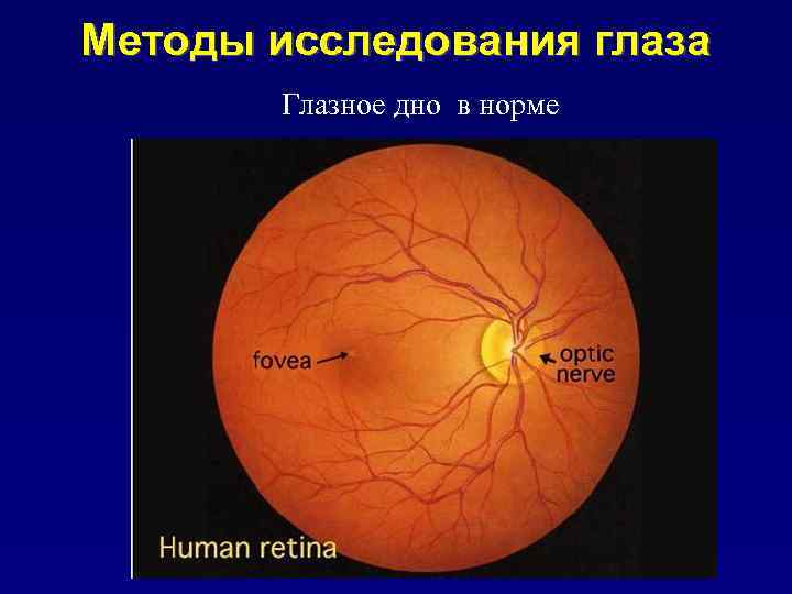 Методы исследования глаза Глазное дно в норме 