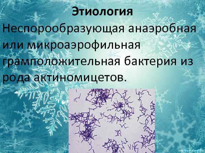 Этиология Неспорообразующая анаэробная или микроаэрофильная грамположительная бактерия из рода актиномицетов. 