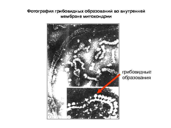 Фотография грибовидных образований во внутренней мембране митохондрии грибовидные образования 