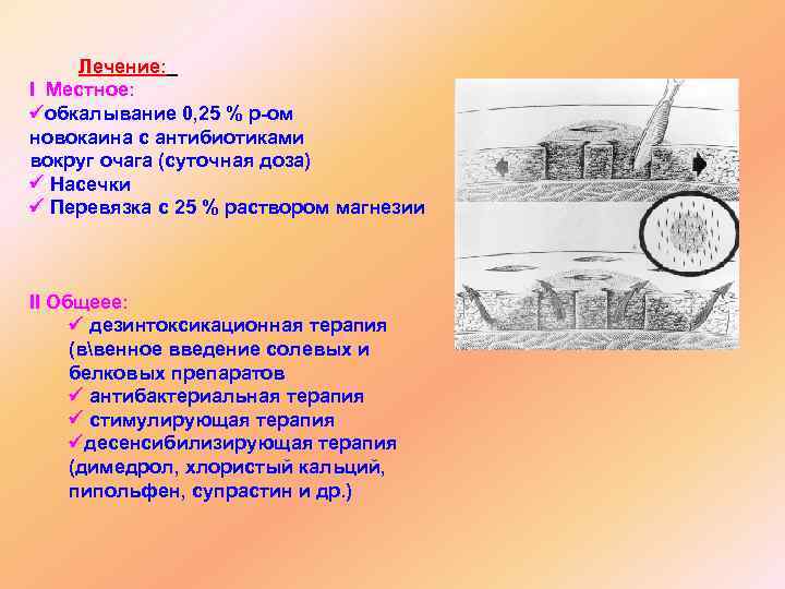 Лечение: І Местное: обкалывание 0, 25 % р-ом новокаина с антибиотиками вокруг очага (суточная