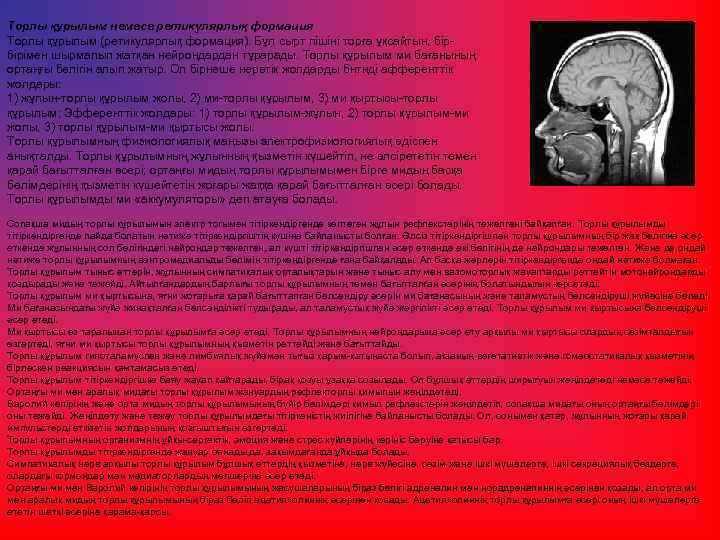 Торлы құрылым немесе ретикулярлық формация Торлы құрылым (ретикулярлық формация). Бұл сырт пішiнi торға ұқсайтын,