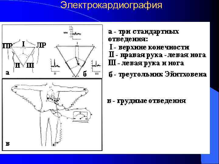 Электрокардиография 