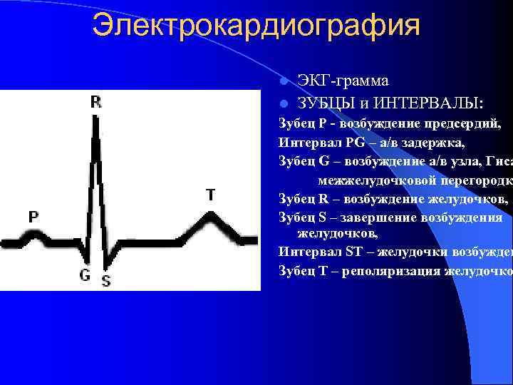 Электрокардиография ЭКГ-грамма l ЗУБЦЫ и ИНТЕРВАЛЫ: l Зубец Р - возбуждение предсердий, Интервал PG