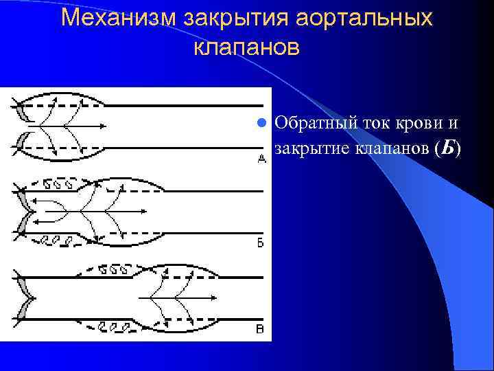 Механизм закрытия аортальных клапанов l Обратный ток крови и закрытие клапанов (Б) 