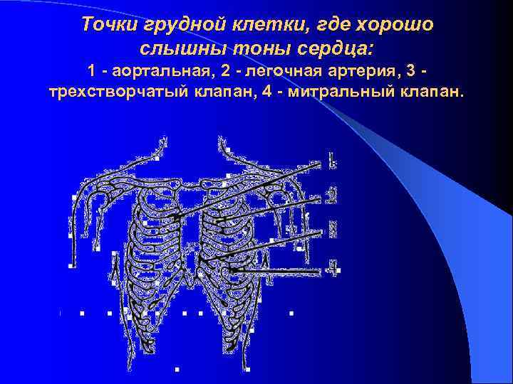 Точки грудной клетки, где хорошо слышны тоны сердца: 1 - аортальная, 2 - легочная