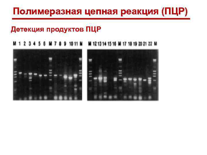 Полимеразная цепная реакция (ПЦР) Детекция продуктов ПЦР 