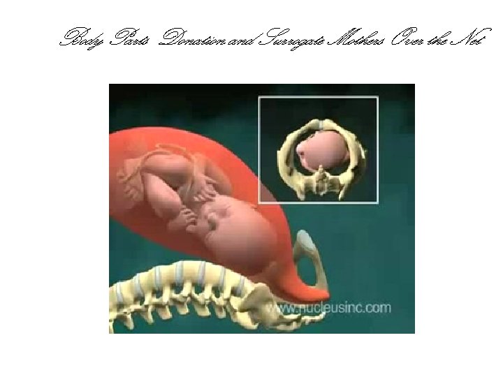 Body Parts Donation and Surrogate Mothers Over the Net 