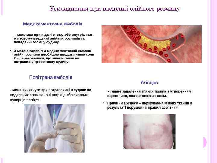 Ускладнення при введенні олійного розчину 