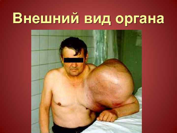 Внешний вид органа 
