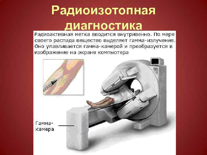 Радиоизотопная диагностика 