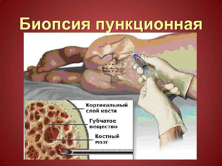 Биопсия пункционная 