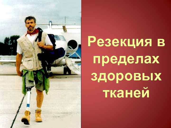 Резекция в пределах здоровых тканей 