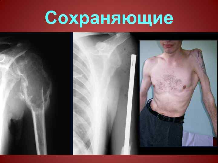 Сохраняющие операции 