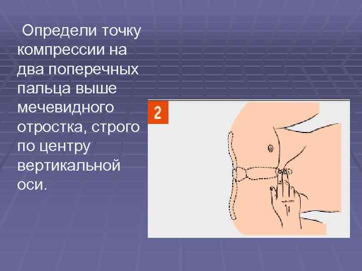  Определи точку компрессии на два поперечных пальца выше мечевидного отростка, строго по центру