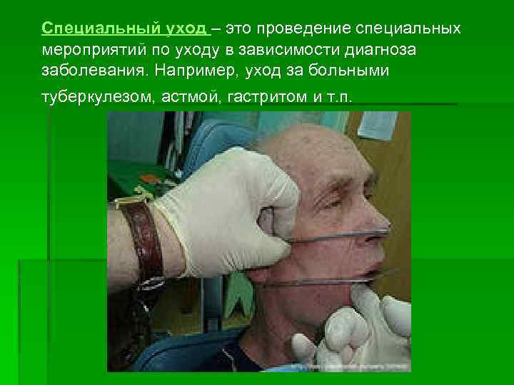 Специальный уход – это проведение специальных мероприятий по уходу в зависимости диагноза заболевания. Например,