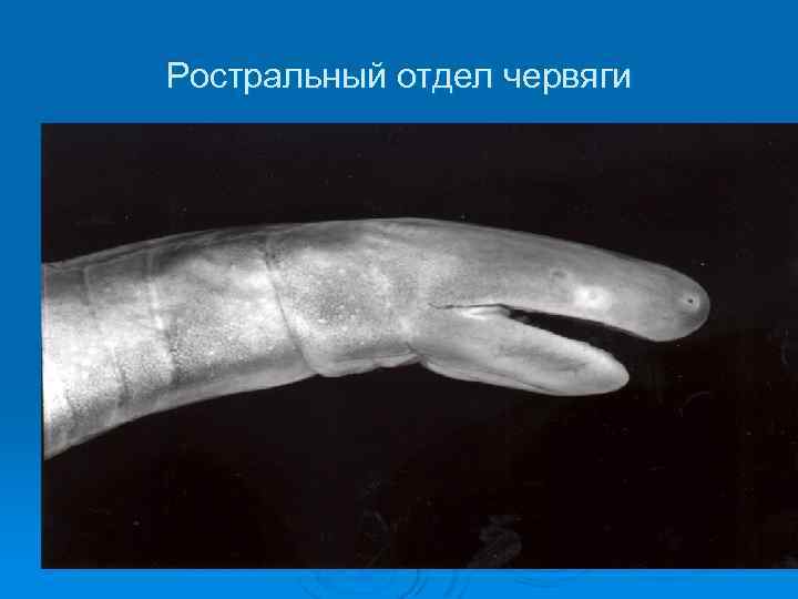 Ростральный отдел червяги 