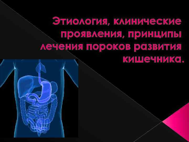 Этиология, клинические проявления, принципы лечения пороков развития кишечника. 