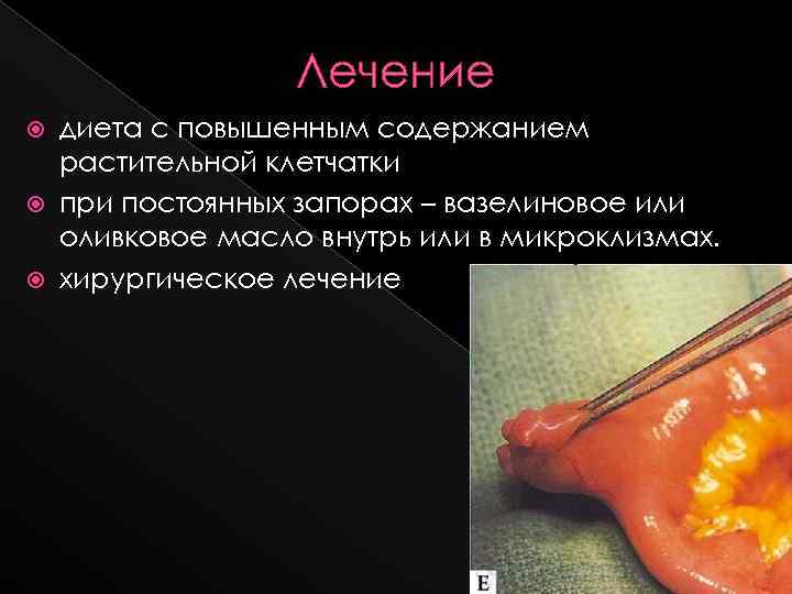 Лечение диета с повышенным содержанием растительной клетчатки при постоянных запорах – вазелиновое или оливковое