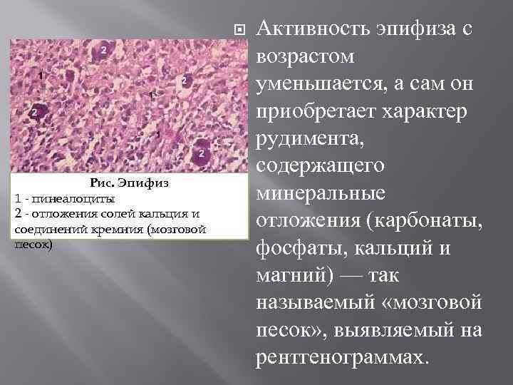  Рис. Эпифиз 1 - пинеалоциты 2 - отложения солей кальция и соединений кремния