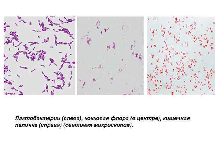 Микрофлора палочки. Лактобациллы-кокковая Флора. Лактобациллы микроскопия. Микроскопия кокковая Флора. Микробиота кокковая.
