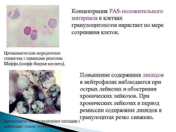 Концентрация PAS-положительного материала в клетках гранулоцитопоэза нарастает по мере созревания клеток. Цитохимические определение гликогена