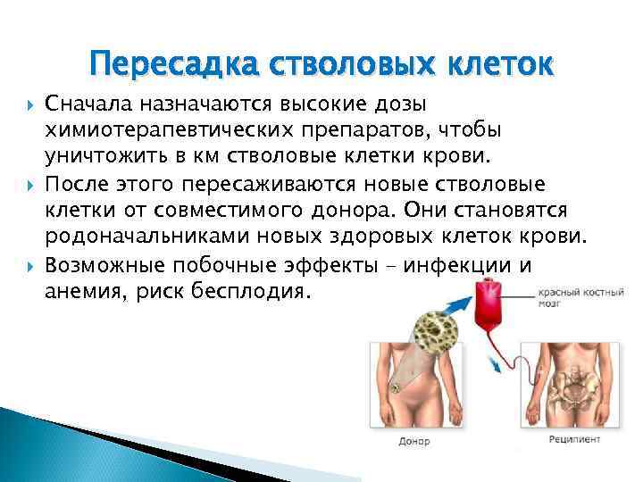 Пересадка стволовых клеток Сначала назначаются высокие дозы химиотерапевтических препаратов, чтобы уничтожить в км стволовые