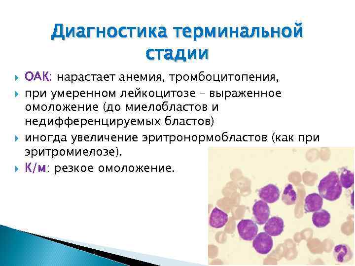 Диагностика терминальной стадии ОАК: нарастает анемия, тромбоцитопения, при умеренном лейкоцитозе – выраженное омоложение (до