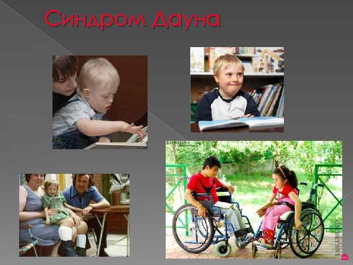 Синдром Дауна 