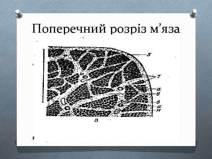 Поперечний розріз м’яза 