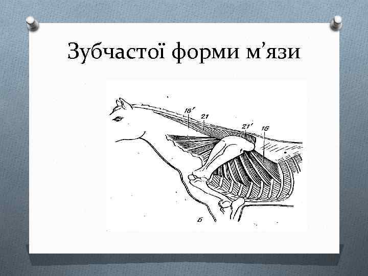 Зубчастої форми м’язи 