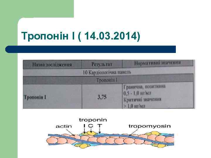 Тропонін І ( 14. 03. 2014) 