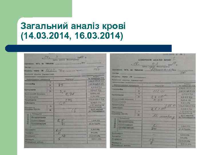 Загальний аналіз крові (14. 03. 2014, 16. 03. 2014) 