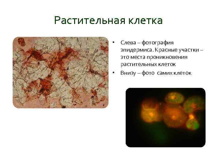 Растительная клетка • Слева – фотография эпидермиса. Красные участки – это места проникновения растительных