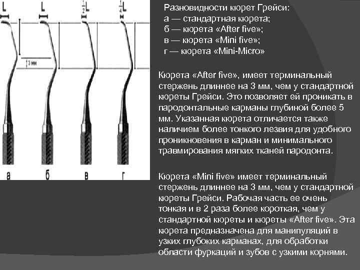 Разновидности кюрет Грейси: а — стандартная кюрета; б — кюрета «After five» ; в