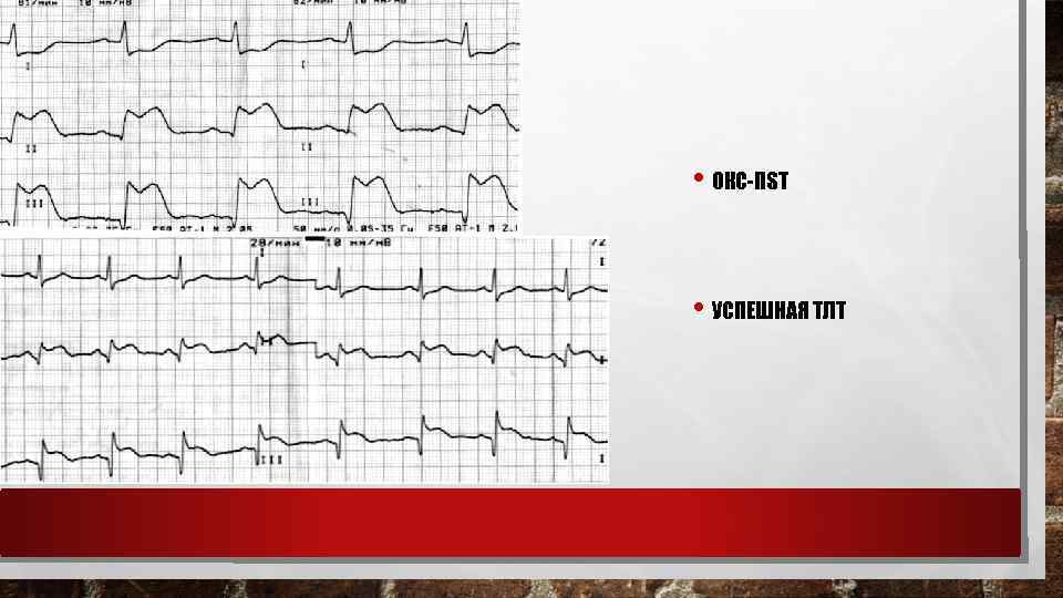  • ОКС-ПST • УСПЕШНАЯ ТЛТ 