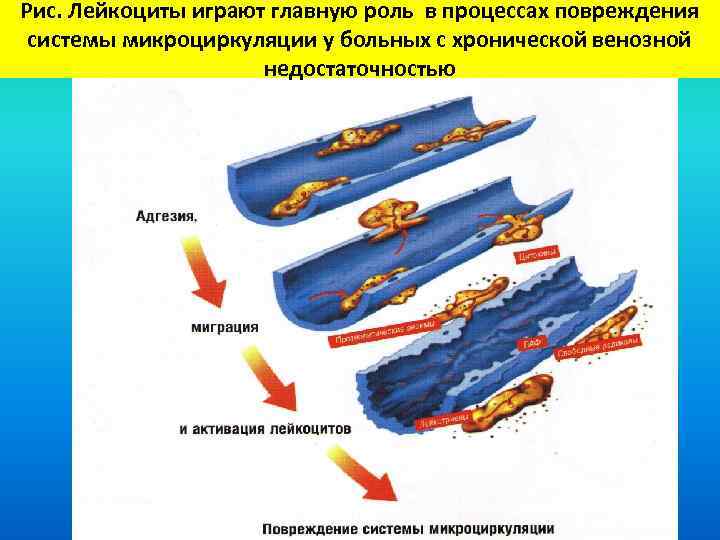 Схема локализации повреждения трубопровода