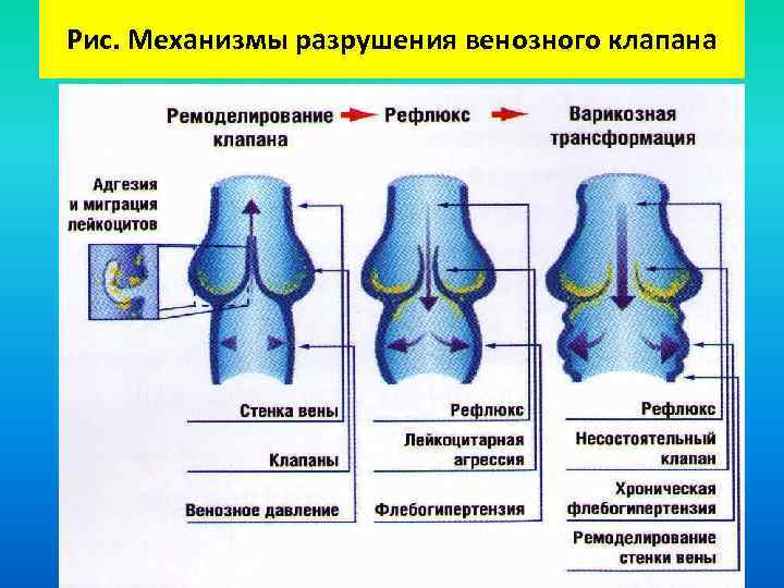 Клапаны вен рисунок