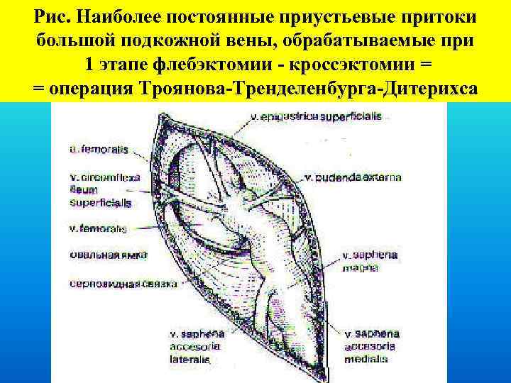 Операция троянова