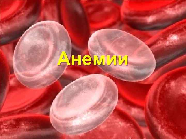 Анемии 