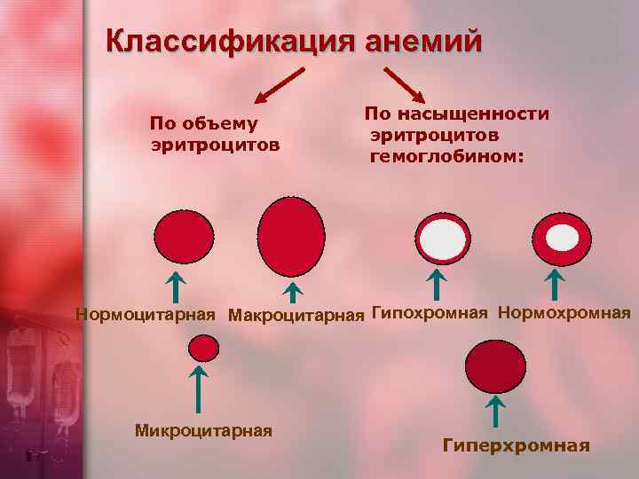 Классификация анемий По объему эритроцитов По насыщенности эритроцитов гемоглобином: Нормоцитарная Макроцитарная Гипохромная Нормохромная Микроцитарная