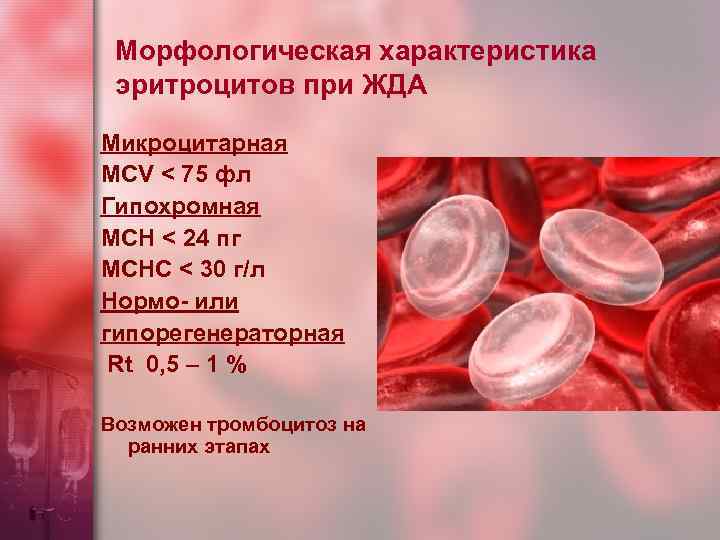 Морфологическая характеристика эритроцитов при ЖДА Микроцитарная MCV < 75 фл Гипохромная MCH < 24