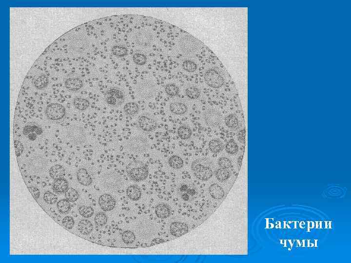 Бактерии чумы 