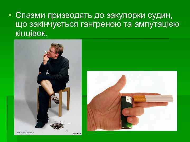 § Спазми призводять до закупорки судин, що закінчується гангреною та ампутацією кінцівок. 