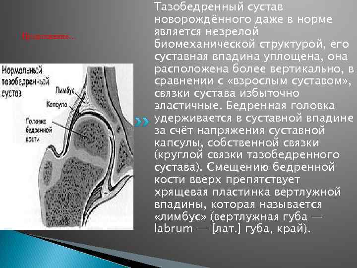 Продолжение… Тазобедренный сустав новорождённого даже в норме является незрелой биомеханической структурой, его суставная впадина