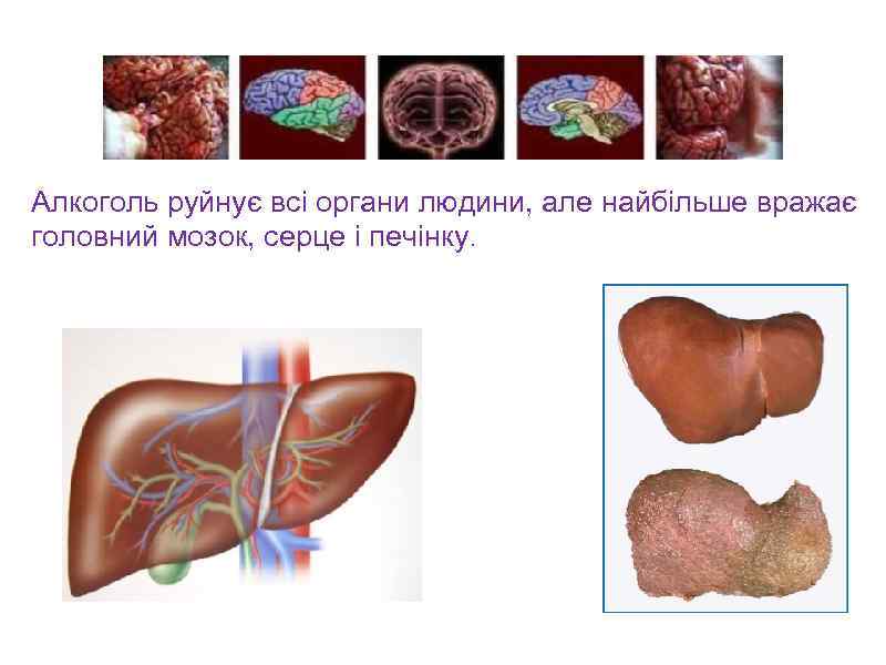 Алкоголь руйнує всі органи людини, але найбільше вражає головний мозок, серце і печінку. 