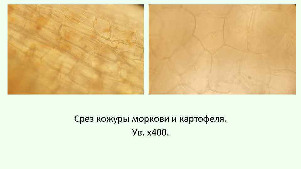 Срез кожуры моркови и картофеля. Ув. х400. 